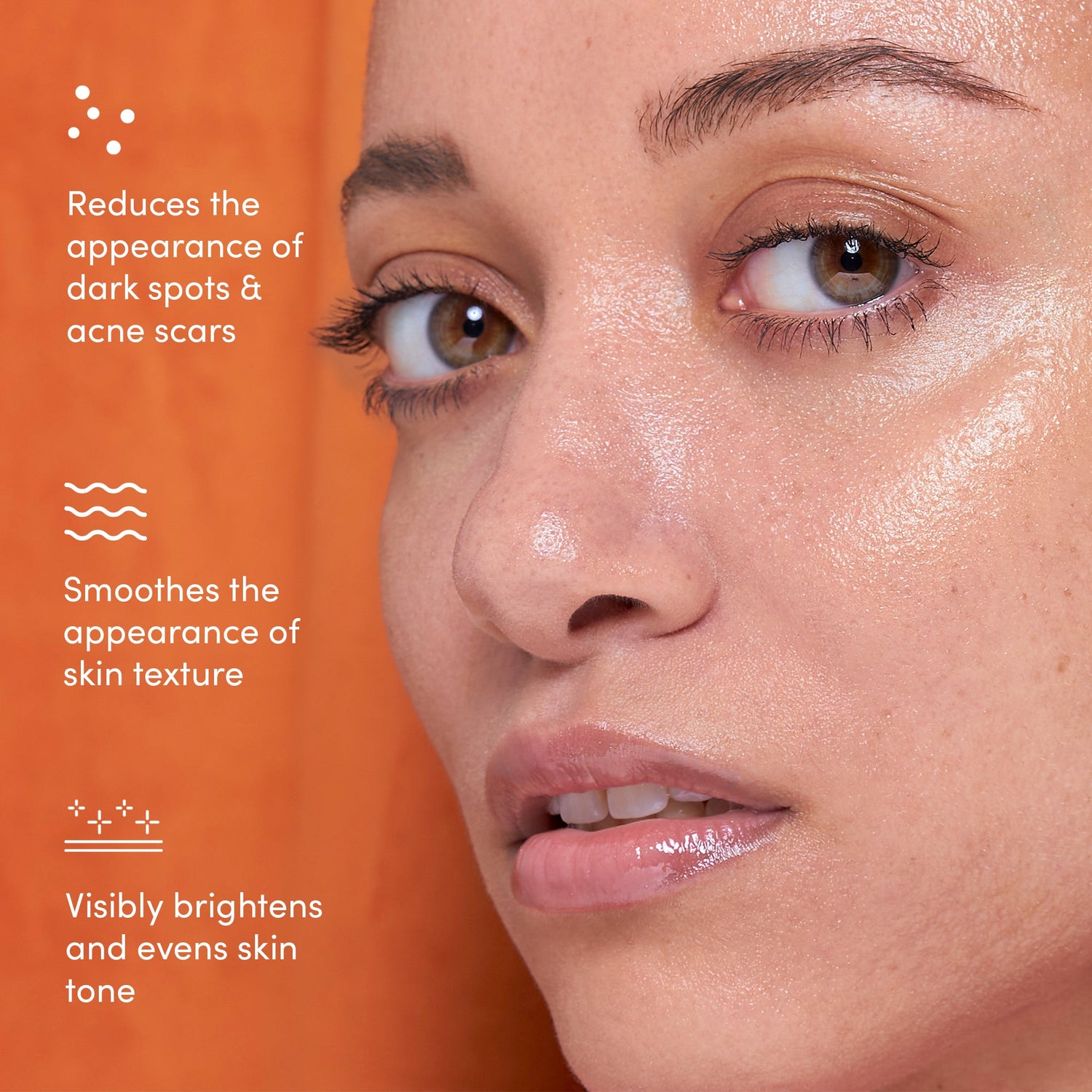Close-up face with dotted circles showing dark spots and acne scars on cheeks